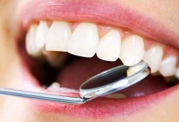 Diş plağı ve tartar nedir, nasıl temizlenir?