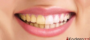 Diş sarılığını gidermek için 13 ipucu