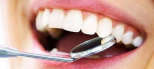 Diş plağı ve tartar nedir, nasıl temizlenir?